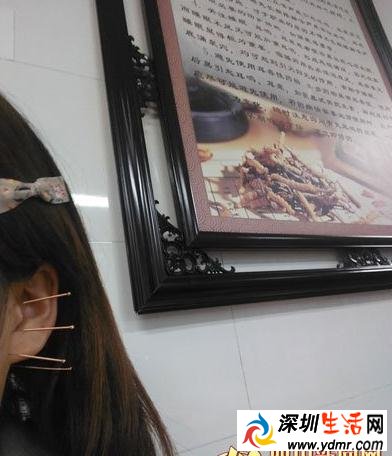 成都女大学生因熬夜导致耳聋