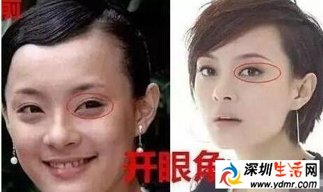 孙俪自曝整过容 整了哪些部位 隆胸需要多少钱