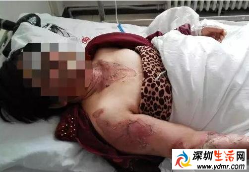 儿媳开水泼婆婆 专家支招如何处理好婆媳关系