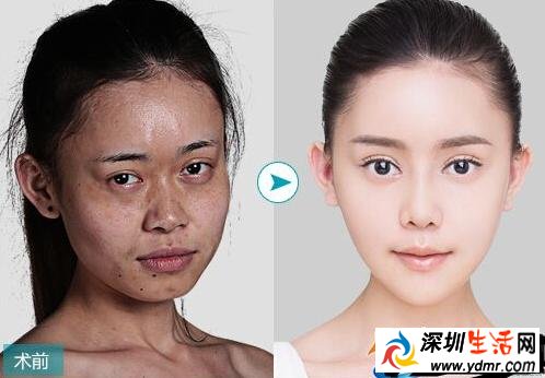吴玉青整容是真的吗 吴玉青整容日记全文曝光
