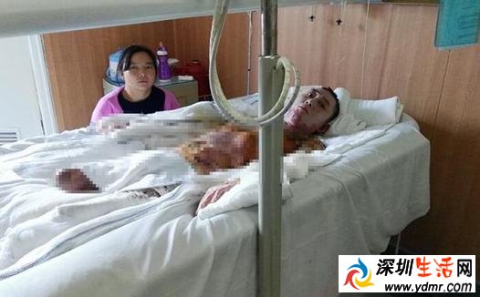 福建泉州中泉制釉有限公司老板暗示安乐死员工 皮肉溃烂老板雪上加霜