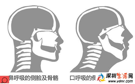 终于找到我丑的原因了 张嘴睡觉会越变越丑是真的!