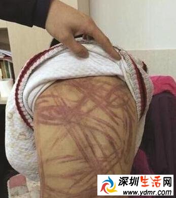 南京虐童案被告人出狱 南京养母虐童案事件回顾