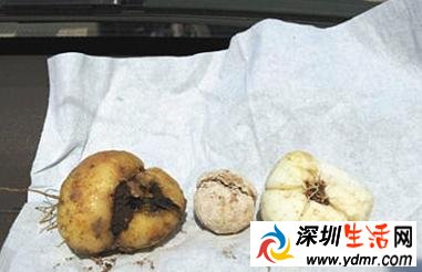 多家知名药企止咳药被检出硫磺 药企名单曝光