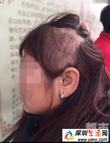 大妈公交车上大声打电话遭殴打 头发被拽掉变秃顶