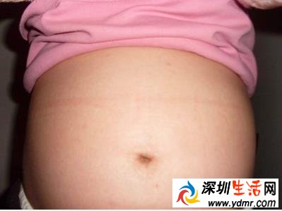 看肚子分辨男孩女孩图 肚子尖是男孩女孩