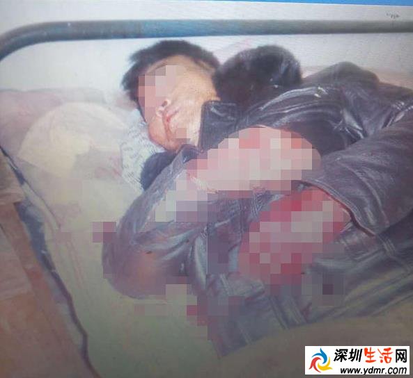 举报村官被殴打
