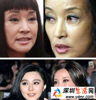 微整形后老了会怎样?整容医生都不整容是真的吗?